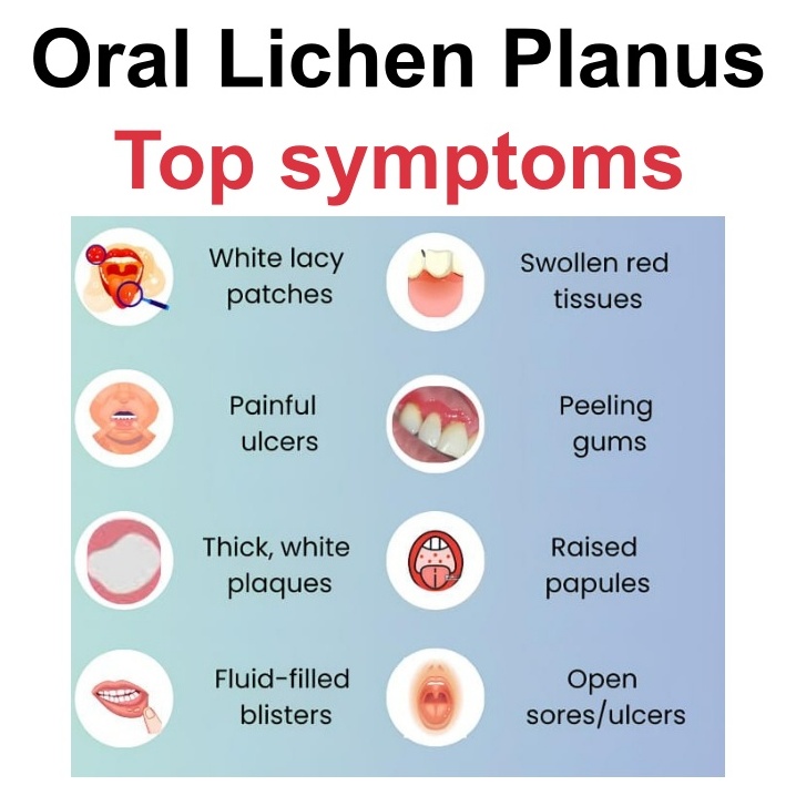 survivingoralcancer.com